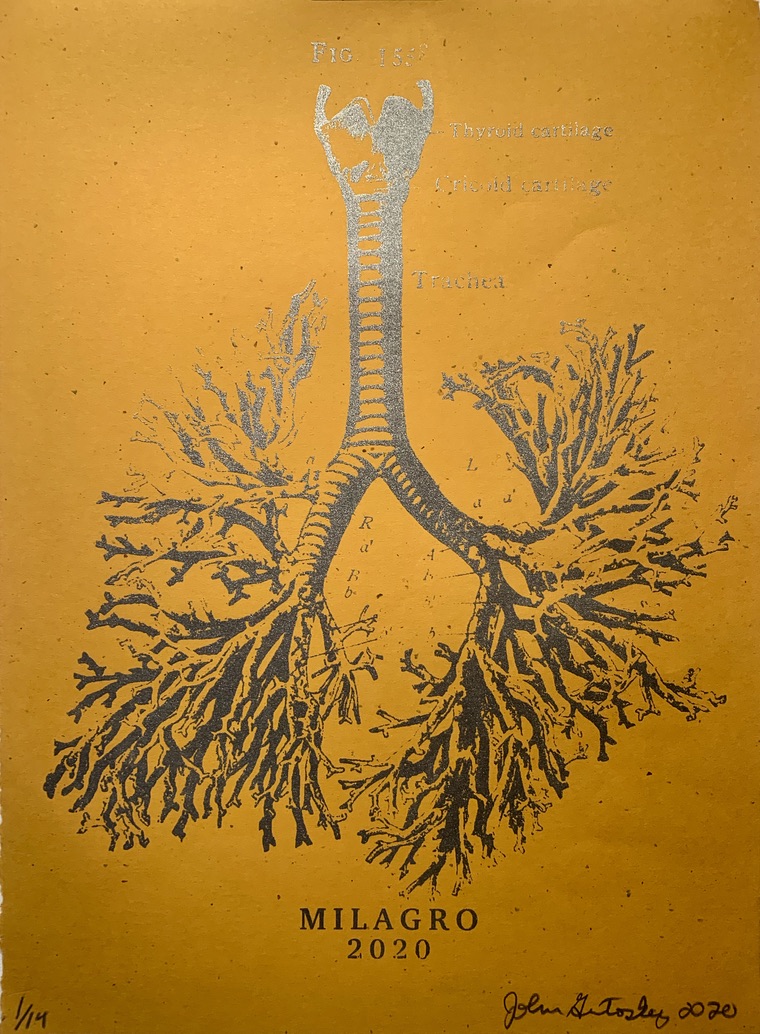 Anatomical Lung Tree Milagro Prints