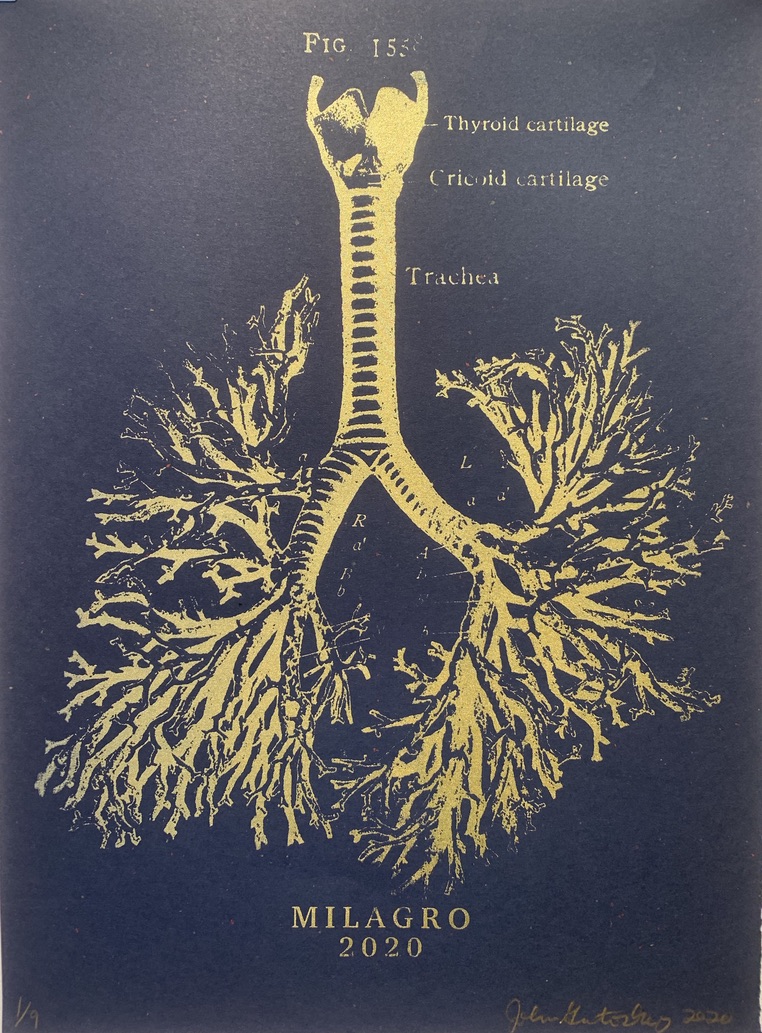 Anatomical Lung Tree Milagro Prints
